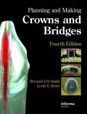 Planificación y fabricación de coronas y puentes - Planning and Making Crowns and Bridges