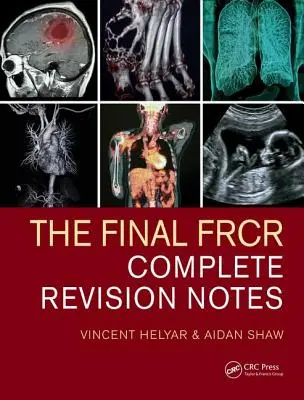 La Frcr Final: Notas de revisión completas - The Final Frcr: Complete Revision Notes