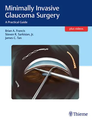 Cirugía mínimamente invasiva del glaucoma: Guía práctica - Minimally Invasive Glaucoma Surgery: A Practical Guide