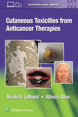 Reacciones cutáneas de las terapias contra el cáncer - Cutaneous Reactions from Anti-Cancer Therapies