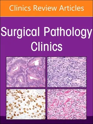 Endocrine Pathology, an Issue of Surgical Pathology Clinics: Volumen 16-1 - Endocrine Pathology, an Issue of Surgical Pathology Clinics: Volume 16-1