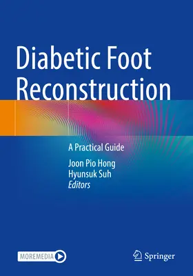 Reconstrucción del pie diabético: Guía práctica - Diabetic Foot Reconstruction: A Practical Guide