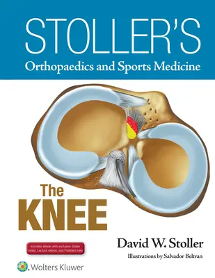 Ortopedia y Medicina Deportiva de Stoller: La rodilla: Incluye vídeos de conferencias de Stoller y apuntes de Stoller - Stoller's Orthopaedics and Sports Medicine: The Knee: Includes Stoller Lecture Videos and Stoller Notes