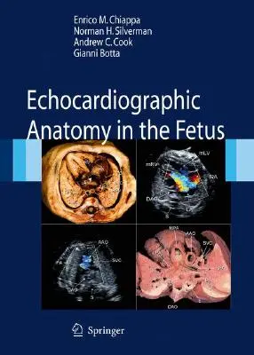 Anatomía ecocardiográfica en el feto [Con DVD] - Echocardiographic Anatomy in the Fetus [With DVD]