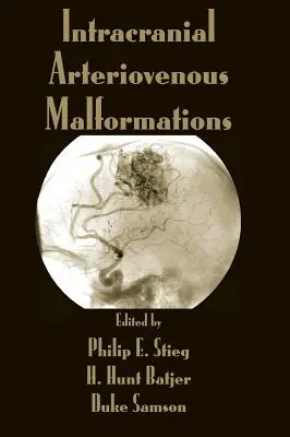 Malformaciones Arteriovenosas Intracraneales - Intracranial Arteriovenous Malformations