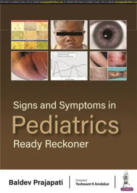 Signos y síntomas en pediatría - Ready Reckoner - Signs and Symptoms in Pediatrics - Ready Reckoner