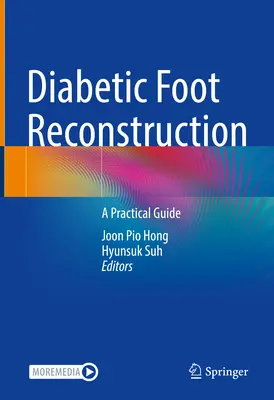 Reconstrucción del pie diabético: Una guía práctica - Diabetic Foot Reconstruction: A Practical Guide