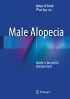 Alopecia masculina: Guía para el manejo exitoso - Male Alopecia: Guide to Successful Management