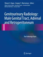 Radiología Genitourinaria: Tracto Genital Masculino, Suprarrenal y Retroperitoneo: Bases patológicas - Genitourinary Radiology: Male Genital Tract, Adrenal and Retroperitoneum: The Pathologic Basis