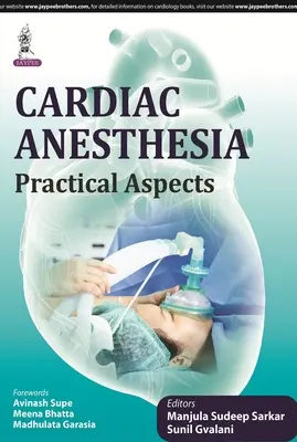 Anestesia cardíaca: Aspectos prácticos - Cardiac Anesthesia: Practical Aspects