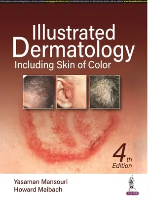 Dermatología ilustrada - Incluida la piel de color - Illustrated Dermatology - Including Skin of Colour