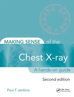 El sentido de la radiografía de tórax: Guía práctica - Making Sense of the Chest X-Ray: A Hands-On Guide