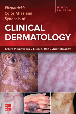 Atlas en color y sinopsis de dermatología clínica de Fitzpatrick, novena edición - Fitzpatrick's Color Atlas and Synopsis of Clinical Dermatology, Ninth Edition
