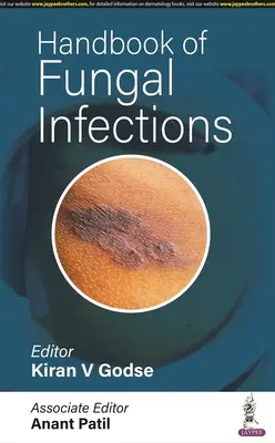 Manual de infecciones fúngicas - Handbook of Fungal Infections