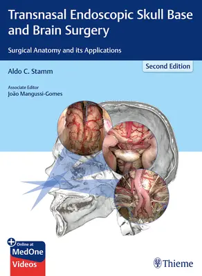 Cirugía endoscópica transnasal de la base del cráneo y el cerebro: Anatomía quirúrgica y sus aplicaciones - Transnasal Endoscopic Skull Base and Brain Surgery: Surgical Anatomy and Its Applications