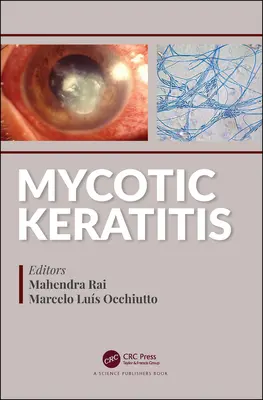 Queratitis micótica - Mycotic Keratitis