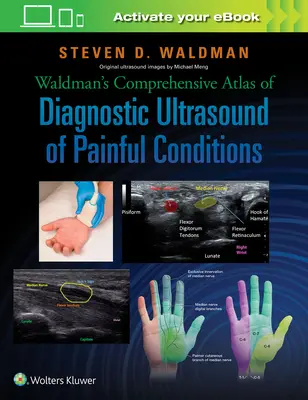 Atlas exhaustivo de ecografía diagnóstica de afecciones dolorosas de Waldman - Waldman's Comprehensive Atlas of Diagnostic Ultrasound of Painful Conditions