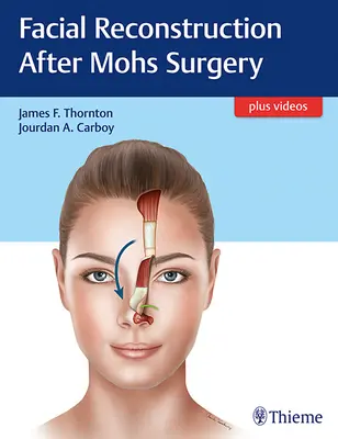 Reconstrucción facial tras cirugía de Mohs - Facial Reconstruction After Mohs Surgery