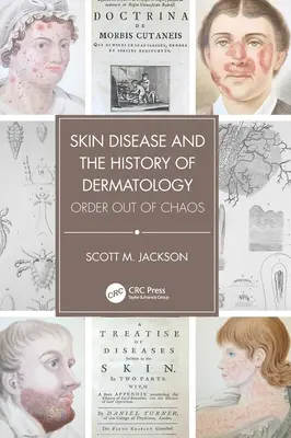 Enfermedades de la piel e historia de la dermatología: El orden del caos - Skin Disease and the History of Dermatology: Order Out of Chaos