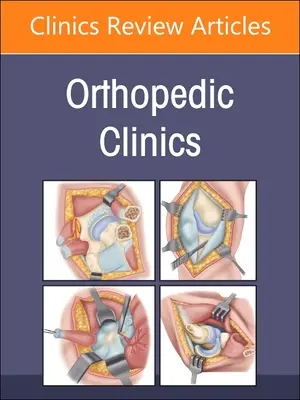 Manejo de las comorbilidades, un número de Orthopedic Clinics: Volumen 54-3 - Managing Comorbidities, an Issue of Orthopedic Clinics: Volume 54-3