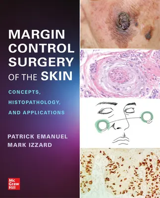 Cirugía De Control Del Margen De La Piel: Conceptos, Histopatología y Aplicaciones - Margin Control Surgery of the Skin: Concepts, Histopathology, and Applications