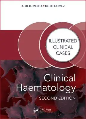 Hematología Clínica: Casos clínicos ilustrados - Clinical Haematology: Illustrated Clinical Cases
