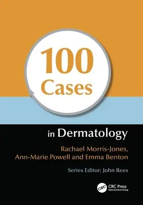 100 casos de dermatología - 100 Cases in Dermatology