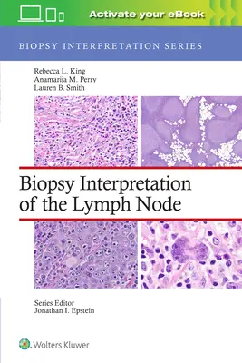 Interpretación de la biopsia del ganglio linfático - Biopsy Interpretation of the Lymph Node