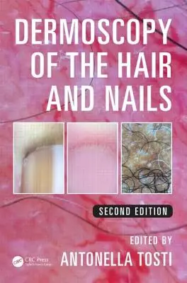 Dermatoscopia del cabello y las uñas - Dermoscopy of the Hair and Nails