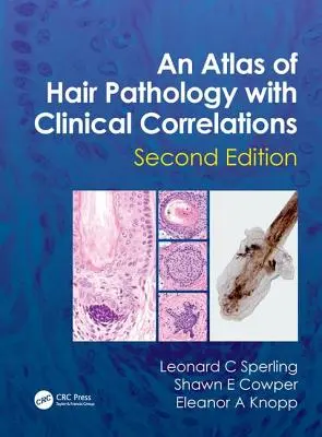 Un Atlas de Patología Capilar con Correlaciones Clínicas - An Atlas of Hair Pathology with Clinical Correlations