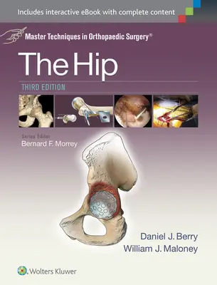 Técnicas Maestras en Cirugía Ortopédica: La cadera - Master Techniques in Orthopaedic Surgery: The Hip