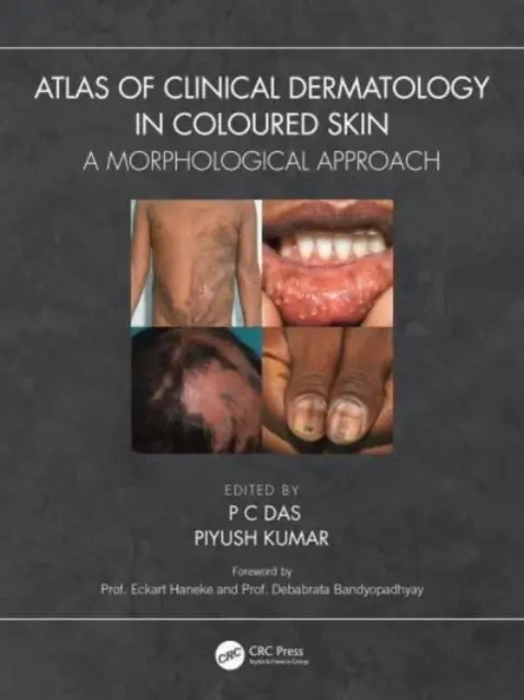 Atlas de dermatología clínica en pieles de color: Un enfoque morfológico - Atlas of Clinical Dermatology in Coloured Skin: A Morphological Approach