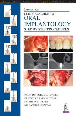 Guía clínica de implantología oral: Procedimientos Paso a Paso - Clinical Guide to Oral Implantology: Step by Step Procedures