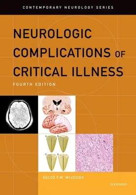 Complicaciones neurológicas de la enfermedad crítica - Neurologic Complications of Critical Illness