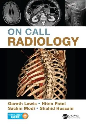 Radiología de guardia - On Call Radiology