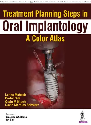 Pasos de la planificación del tratamiento en implantología oral: Atlas en color - Treatment Planning Steps in Oral Implantology: A Color Atlas