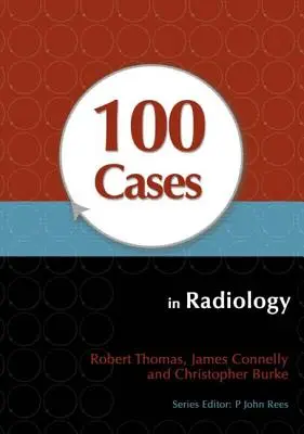 100 casos de radiología - 100 Cases in Radiology