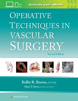 Técnicas operatorias en cirugía vascular - Operative Techniques in Vascular Surgery
