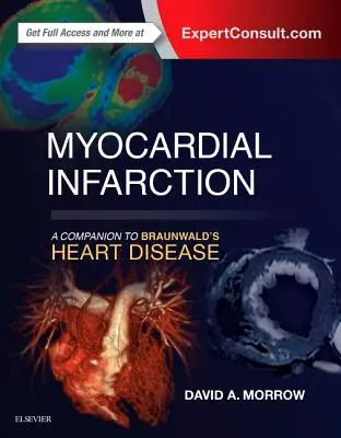 Infarto de miocardio: Un compañero para la enfermedad cardíaca de Braunwald - Myocardial Infarction: A Companion to Braunwald's Heart Disease