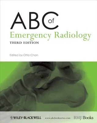 ABC de la radiología de urgencias - ABC of Emergency Radiology