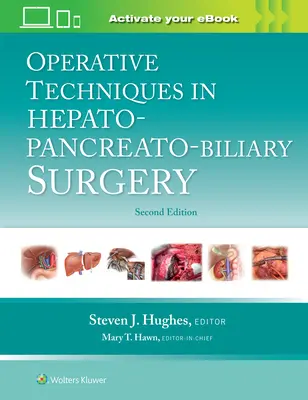 Técnicas operatorias en cirugía hepato-pancreatobiliar - Operative Techniques in Hepato-Pancreato-Biliary Surgery