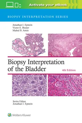 Interpretación de la biopsia de vejiga - Biopsy Interpretation of the Bladder