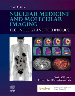 Medicina Nuclear e Imagen Molecular: Tecnología y Técnicas - Nuclear Medicine and Molecular Imaging: Technology and Techniques