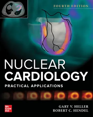 Cardiología Nuclear: Aplicaciones Prácticas, Cuarta Edición - Nuclear Cardiology: Practical Applications, Fourth Edition