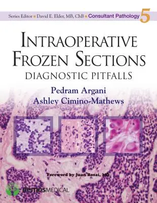 Secciones congeladas intraoperatorias: Trampas diagnósticas - Intraoperative Frozen Sections: Diagnostic Pitfalls