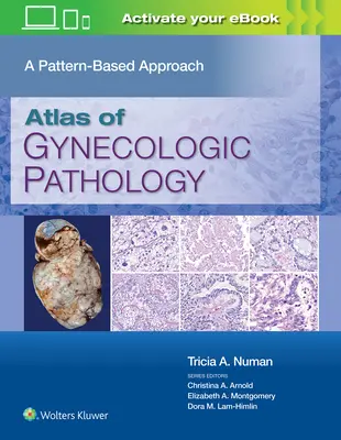 Atlas de patología ginecológica: Un enfoque basado en patrones - Atlas of Gynecologic Pathology: A Pattern-Based Approach