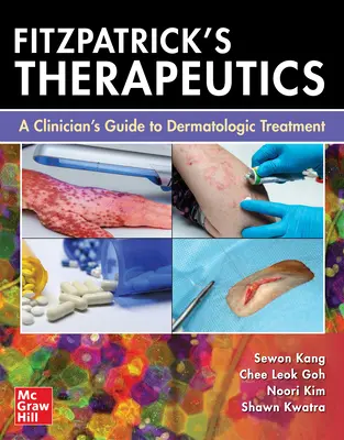 Fitzpatrick's Therapeutics: Guía del clínico para el tratamiento dermatológico - Fitzpatrick's Therapeutics: A Clinician's Guide to Dermatologic Treatment