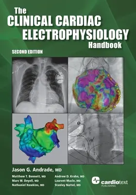 Manual de electrofisiología cardiaca clínica, segunda edición - The Clinical Cardiac Electrophysiology Handbook, Second Edition