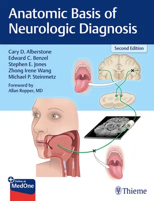 Bases anatómicas del diagnóstico neurológico - Anatomic Basis of Neurologic Diagnosis