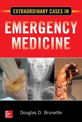 Casos extraordinarios en medicina de urgencias - Extraordinary Cases in Emergency Medicine